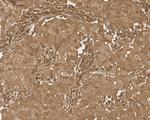 STAT1 Antibody in Immunohistochemistry (Paraffin) (IHC (P))