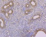 Alpha-2-macroglobulin Antibody in Immunohistochemistry (Paraffin) (IHC (P))