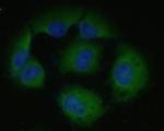 ICAM-1 Antibody in Immunocytochemistry (ICC/IF)
