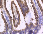 Cytokeratin 8 Antibody in Immunohistochemistry (Paraffin) (IHC (P))