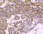 Cytokeratin 8 Antibody in Immunohistochemistry (Paraffin) (IHC (P))