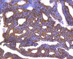 Cytokeratin 8 Antibody in Immunohistochemistry (Paraffin) (IHC (P))