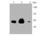 Cytokeratin 8 Antibody in Western Blot (WB)