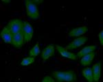 LAMP2 Antibody in Immunocytochemistry (ICC/IF)