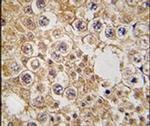 M6PR Antibody in Immunohistochemistry (IHC)