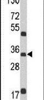 M6PR Antibody in Western Blot (WB)