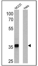 SOX2 Monoclonal Antibody (20G5), HRP