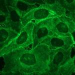 E-selectin Antibody in Immunocytochemistry (ICC/IF)