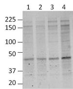 O-linked N-acetylglucosamine (O-GlcNAc) Monoclonal Antibody (RL2)