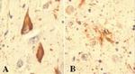 Ubiquitin Antibody in Immunohistochemistry (IHC)