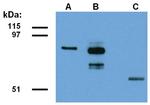 ABRA1 Monoclonal Antibody (ABRA1-01)