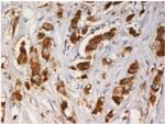AGR3 Monoclonal Antibody (AGR3.1)