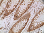 EpCAM Antibody in Immunohistochemistry (Paraffin) (IHC (P))