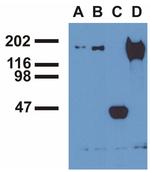 Phospho-EGFR (Tyr1173) Antibody in Immunoprecipitation (IP)