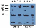 Phospho-EGFR (Tyr1173) Antibody in Immunoprecipitation (IP)
