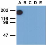 Phospho-EGFR (Tyr1173) Antibody in Western Blot (WB)
