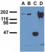 Phospho-EGFR (Tyr992) Antibody in Immunoprecipitation (IP)