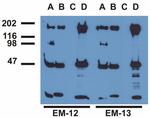 Phospho-EGFR (Tyr992) Antibody in Immunoprecipitation (IP)