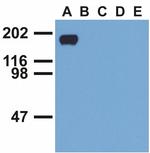 Phospho-EGFR (Tyr992) Antibody in Western Blot (WB)