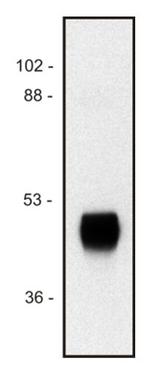 HRP Monoclonal Antibody (HP-03)