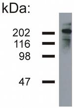 NF-H Monoclonal Antibody (NF-05)