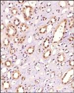 POLE3 Antibody in Immunohistochemistry (Paraffin) (IHC (P))