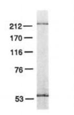 POLE3 Antibody in Western Blot (WB)