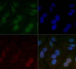 HIF-1 beta Monoclonal Antibody (H1beta234)