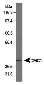 DMC1 Antibody in Western Blot (WB)