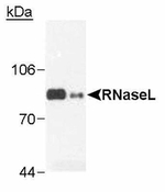 RNaseL Antibody in Western Blot (WB)