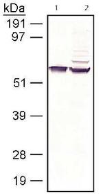 RPE65 Antibody in Western Blot (WB)