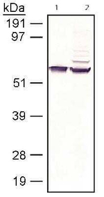 RPE65 Antibody in Western Blot (WB)