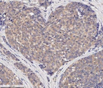 MMP2 Antibody in Immunohistochemistry (Paraffin) (IHC (P))