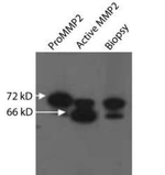 MMP2 Antibody in Western Blot (WB)