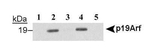 p19ARF Antibody in Immunoprecipitation (IP)