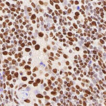 hnRNP M3-M4 Antibody in Immunohistochemistry (Paraffin) (IHC (P))