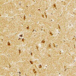 STEP Antibody in Immunohistochemistry (Paraffin) (IHC (P))