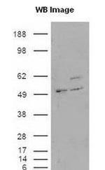 HIP1R Antibody in Western Blot (WB)