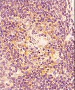 Active/Pro-Caspase 3 Antibody in Immunohistochemistry (Paraffin) (IHC (P))