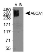 ABCA1 Antibody in Western Blot (WB)