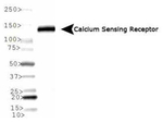 Calcium Sensing Receptor Antibody in Western Blot (WB)