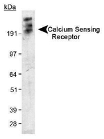 Calcium Sensing Receptor Antibody in Western Blot (WB)