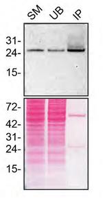 RAB27A Antibody in Immunoprecipitation (IP)