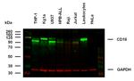 CD18 Antibody in Western Blot (WB)