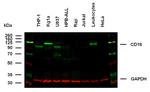 CD18 Antibody in Western Blot (WB)