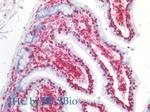 CD45 Antibody in Immunohistochemistry (Paraffin) (IHC (P))