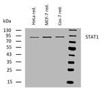 STAT1 Monoclonal Antibody (SM1)