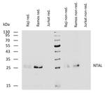 NTAL Antibody in Western Blot (WB)
