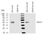 HLA-G Monoclonal Antibody (MEM-G/4)