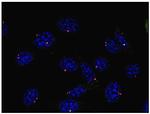 gamma Tubulin Antibody in Immunocytochemistry (ICC/IF)